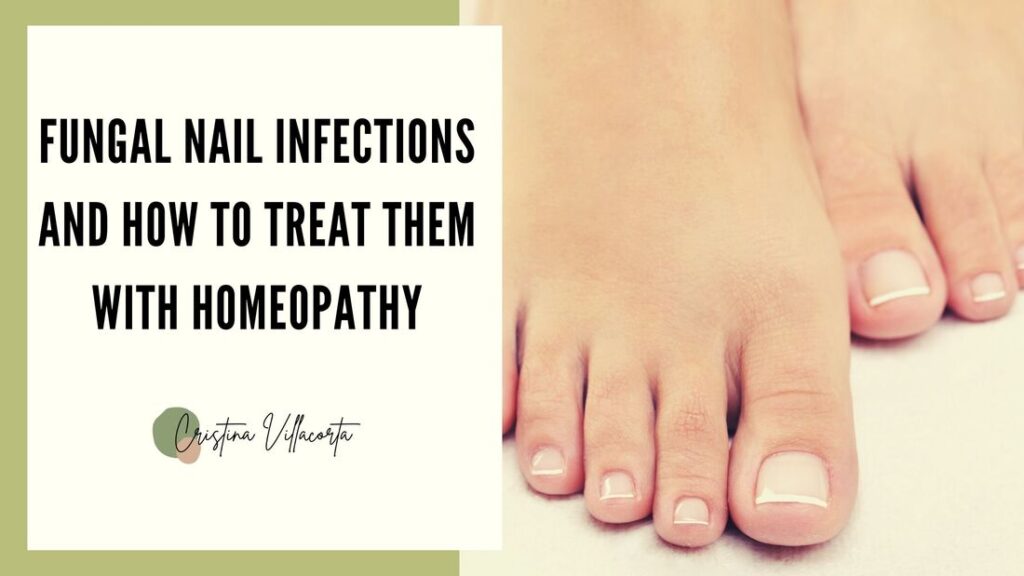 Blog Guide to Homeopathy Treatments Cristina Villacorta